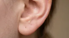 Varför det finns så mycket öronvax: sanningen som ingen talar om